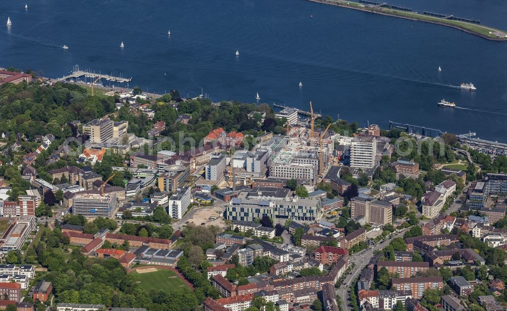 Aerial photograph Kiel - Construction site for a new extension to the hospital grounds Universitaetsklinikum Schleswig-Holstein in Kiel in the state Schleswig-Holstein, Germany