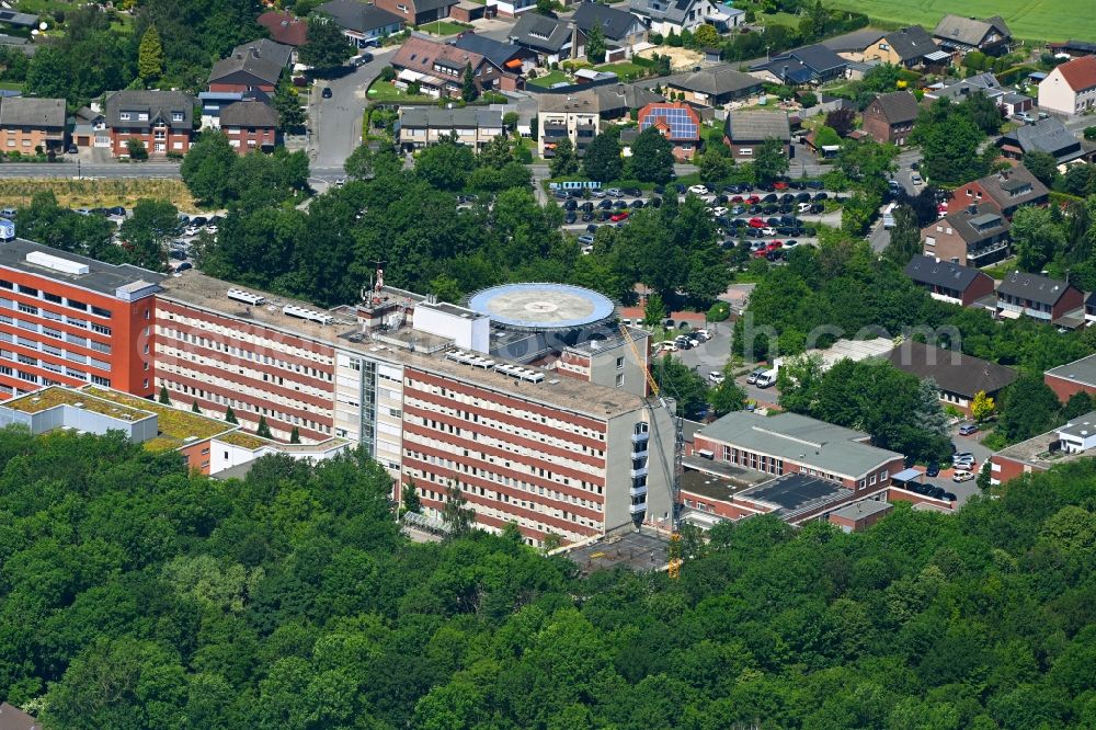 Hamm from the bird's eye view: Construction site for the renovation of a building on the clinic premises of the hospital St. Barbara-Klinik Hamm-Heessen GmbH Abteilung fuer Urologie Am Heessener Wald in the district Heessen in Hamm at Ruhrgebiet in the state North Rhine-Westphalia, Germany