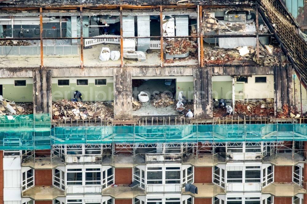 Aerial image Bochum - Burn damage on building Berufsgenossenschaftliches Universitaetsklinikum Bergmannsheil am Buerkle de la Camp-Platz in Bochum in the state North Rhine-Westphalia