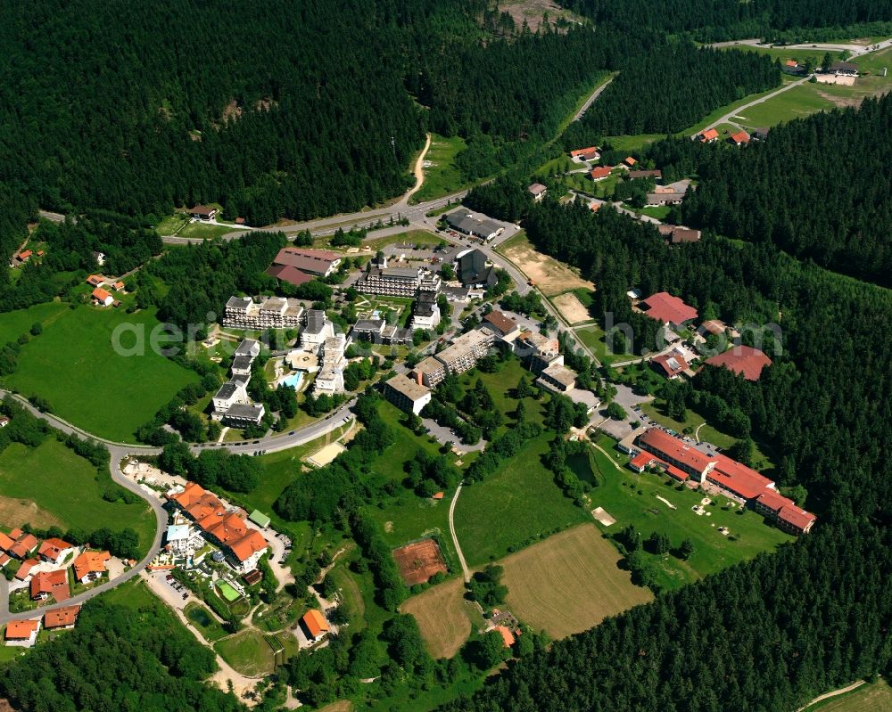 Sankt Englmar from the bird's eye view: Building complex of the hotel complex Predigtstuhl Resort GmbH Am Predigtstuhl in Sankt Englmar in the state Bavaria, Germany