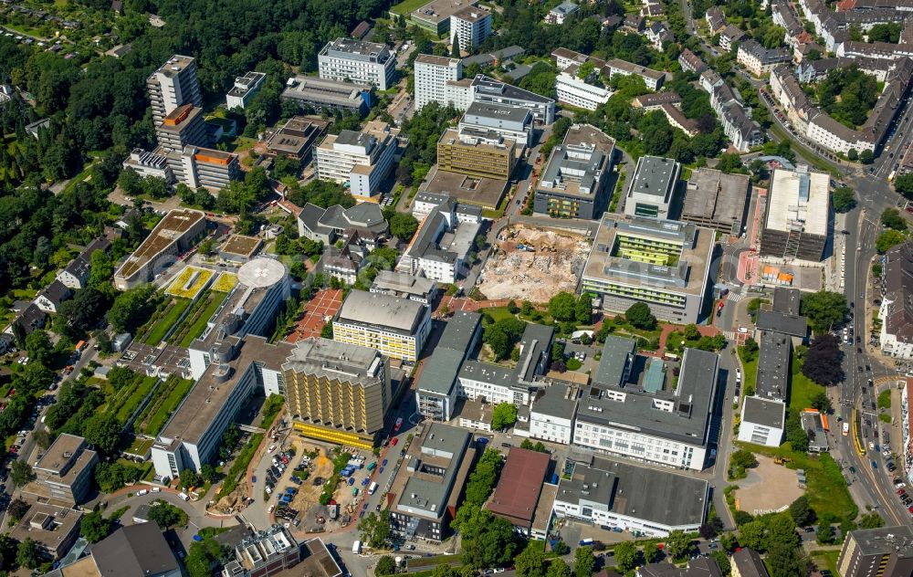 Aerial photograph Essen - Skyscraper on the hospital grounds of Universitaetsklinikum Essen in Essen in the state North Rhine-Westphalia