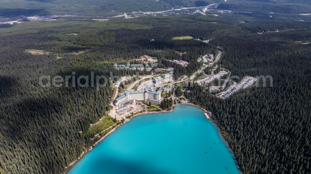 Aerial photograph Lake Louise - Complex of the hotel building Fairmont Chateau Lake Louise on street Lake Louise Drive in Lake Louise in Alberta, Canada