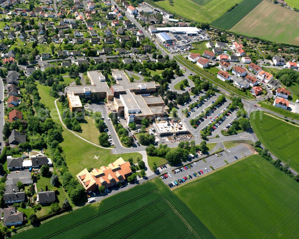 Aerial image Alsfeld - Hospital grounds of the Clinic Kreiskrankenhaus of Vogelsbergkreises on street Schwabenroeder Strasse in Alsfeld GmbH on street Schwabenroeder Strasse in Alsfeld in the state Hesse, Germany