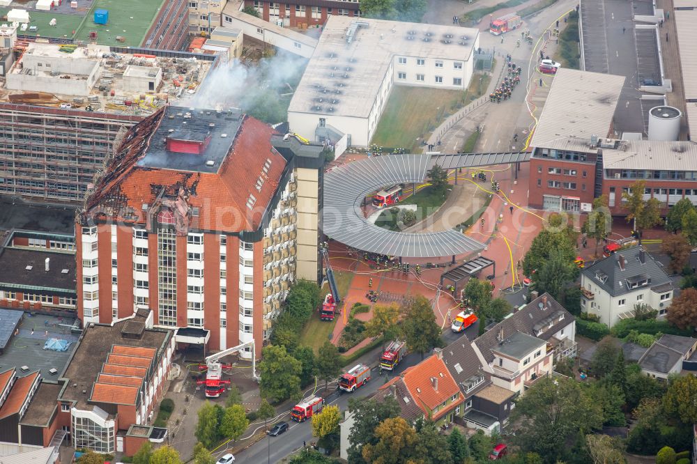 Bochum from above - Clinic grounds of the hospital BG Universitaetsklinikum Bergmannsheil Bochum at Buerkle-de-la-Camp-Platz in the district of Bochum Sued in Bochum in the Ruhr area in the federal state of North Rhine-Westphalia, Germany