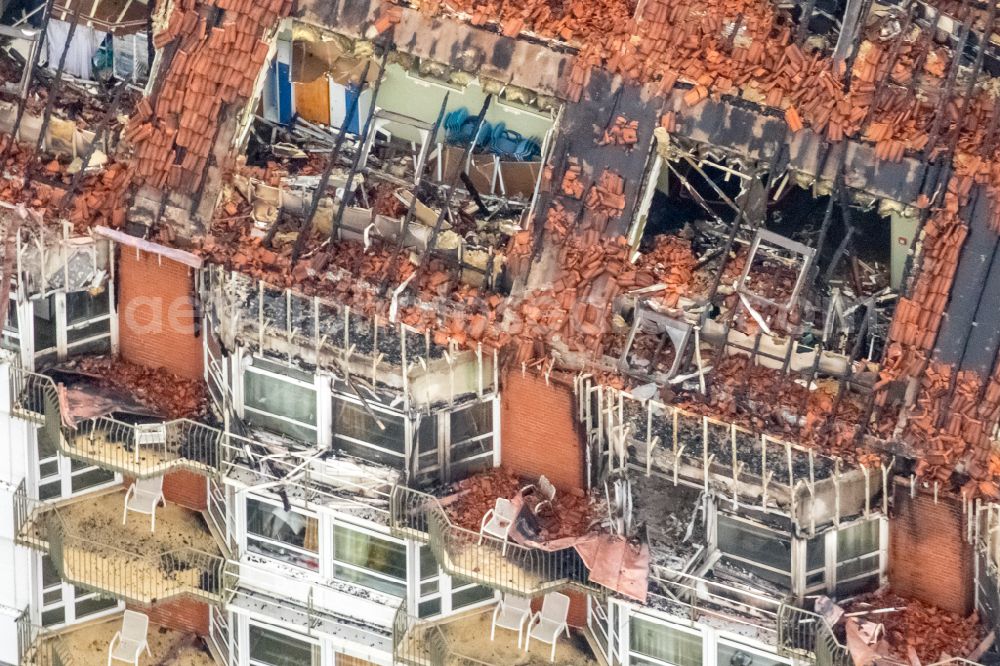 Aerial image Bochum - Clinic grounds of the hospital BG Universitaetsklinikum Bergmannsheil Bochum at Buerkle-de-la-Camp-Platz in the district of Bochum Sued in Bochum in the Ruhr area in the federal state of North Rhine-Westphalia, Germany