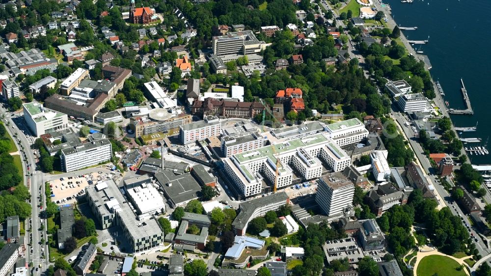 Aerial photograph Kiel - Hospital grounds of the Clinic Universitaetsklinikum Schleswig-Holstein ( UKSH ) on street Arnold-Heller-Strasse in the district Duesternbrook in Kiel in the state Schleswig-Holstein, Germany