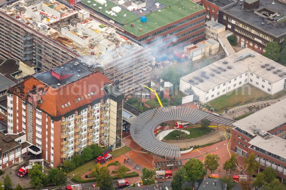 Bochum from above - Fire fighting at the fire brigade on fire the building Berufsgenossenschaftliches Universitaetsklinikum Bergmannsheil am Buerkle de la Camp-Platz in Bochum in the state North Rhine-Westphalia