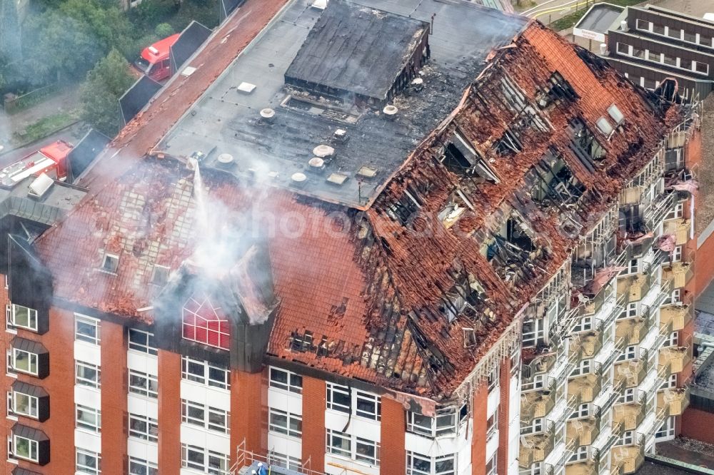 Bochum from above - Fire fighting at the fire brigade on fire the building Berufsgenossenschaftliches Universitaetsklinikum Bergmannsheil am Buerkle de la Camp-Platz in Bochum in the state North Rhine-Westphalia