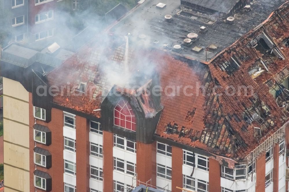 Bochum from above - Fire fighting at the fire brigade on fire the building Berufsgenossenschaftliches Universitaetsklinikum Bergmannsheil am Buerkle de la Camp-Platz in Bochum in the state North Rhine-Westphalia