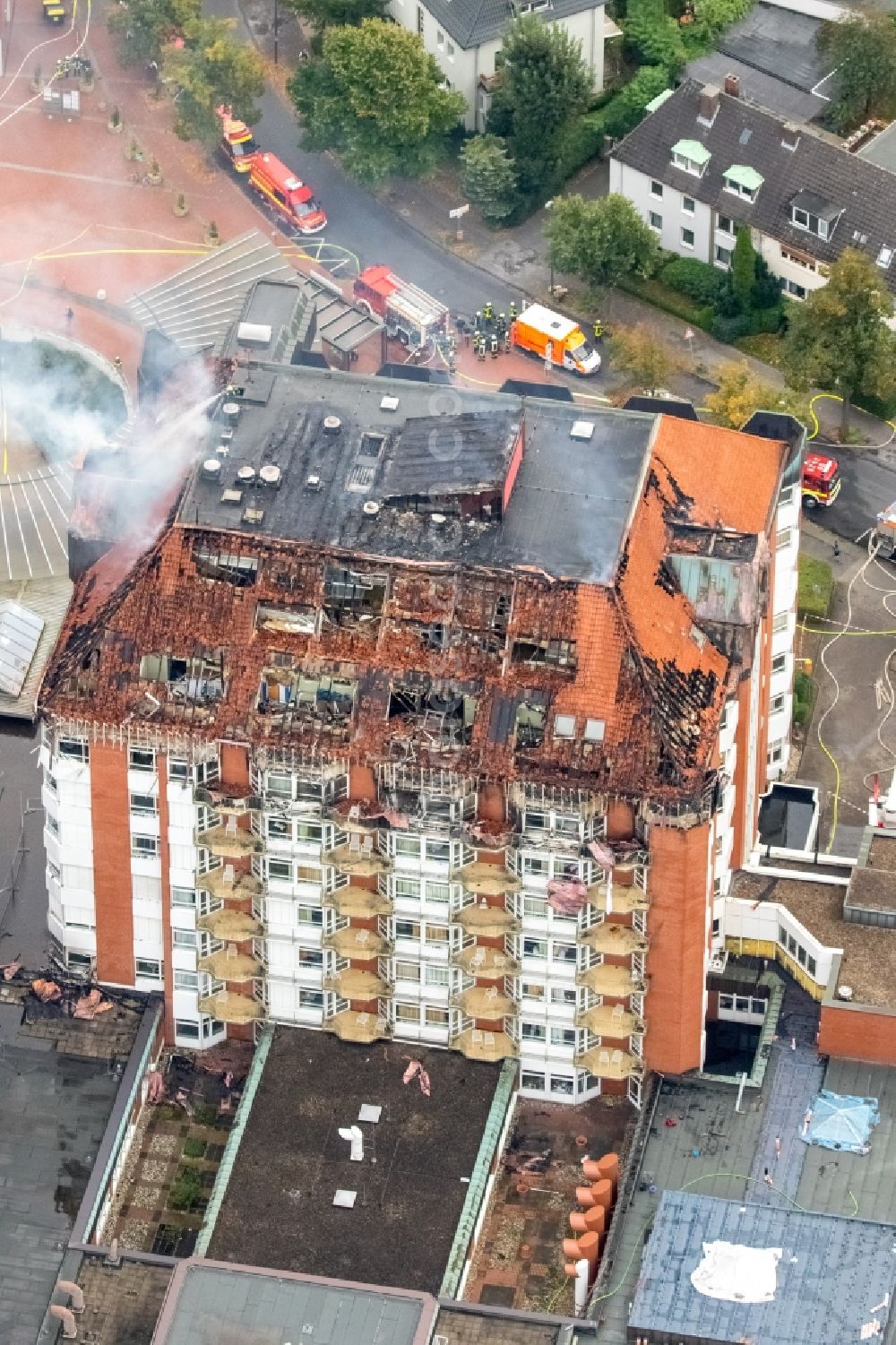 Bochum from above - Fire fighting at the fire brigade on fire the building Berufsgenossenschaftliches Universitaetsklinikum Bergmannsheil am Buerkle de la Camp-Platz in Bochum in the state North Rhine-Westphalia