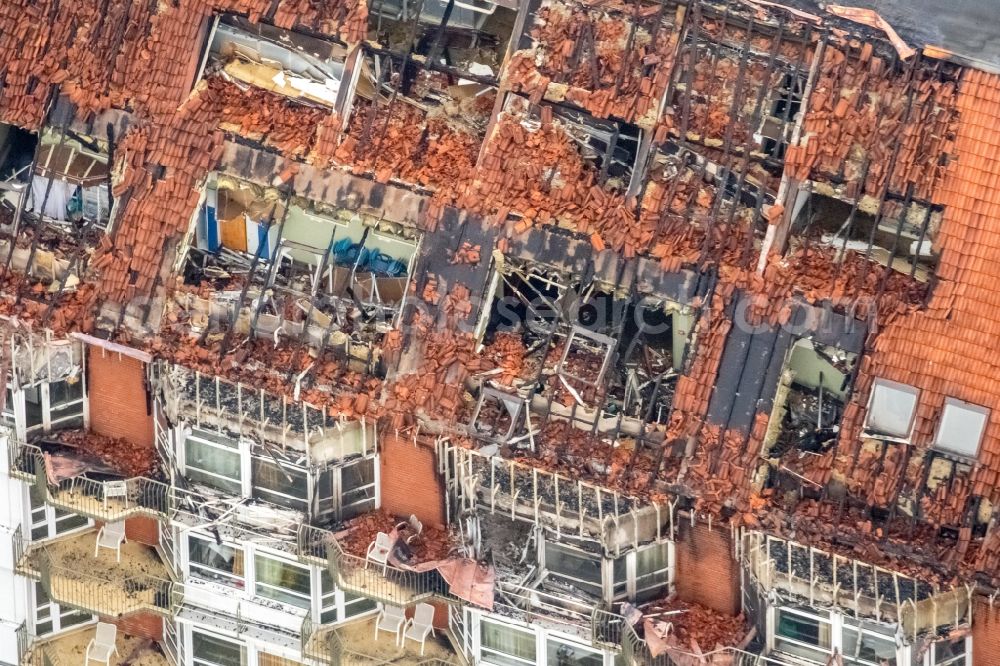 Bochum from the bird's eye view: Fire fighting at the fire brigade on fire the building Berufsgenossenschaftliches Universitaetsklinikum Bergmannsheil am Buerkle de la Camp-Platz in Bochum in the state North Rhine-Westphalia