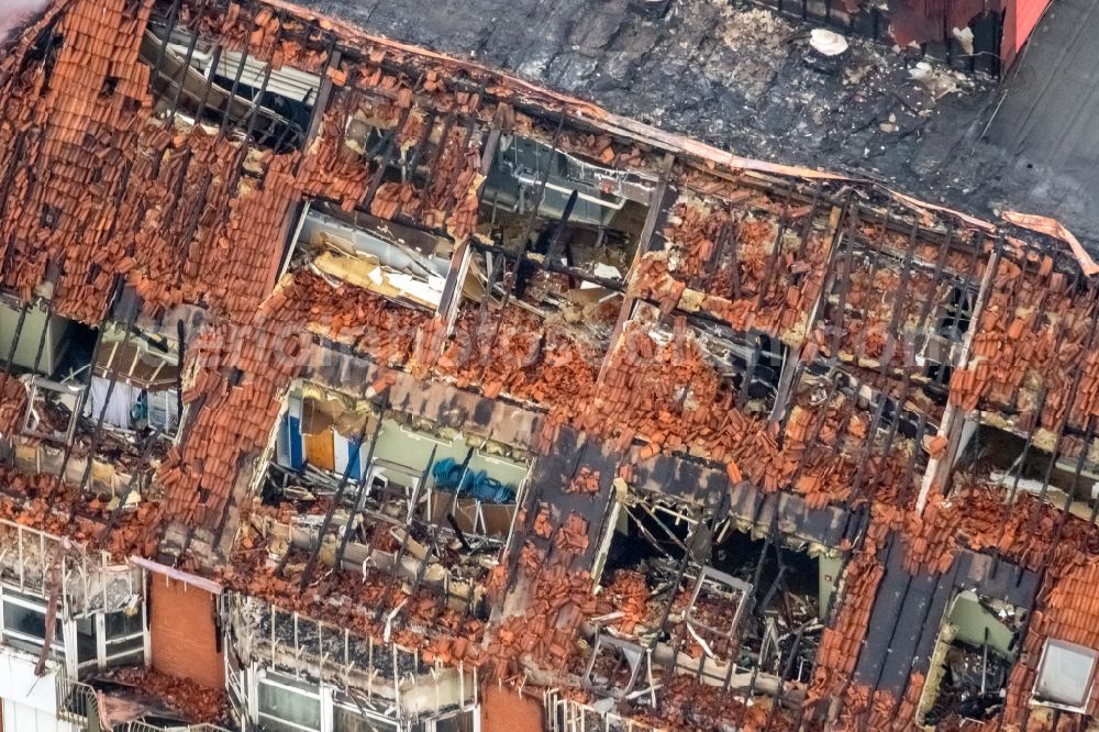 Aerial photograph Bochum - Fire fighting at the fire brigade on fire the building Berufsgenossenschaftliches Universitaetsklinikum Bergmannsheil am Buerkle de la Camp-Platz in Bochum in the state North Rhine-Westphalia